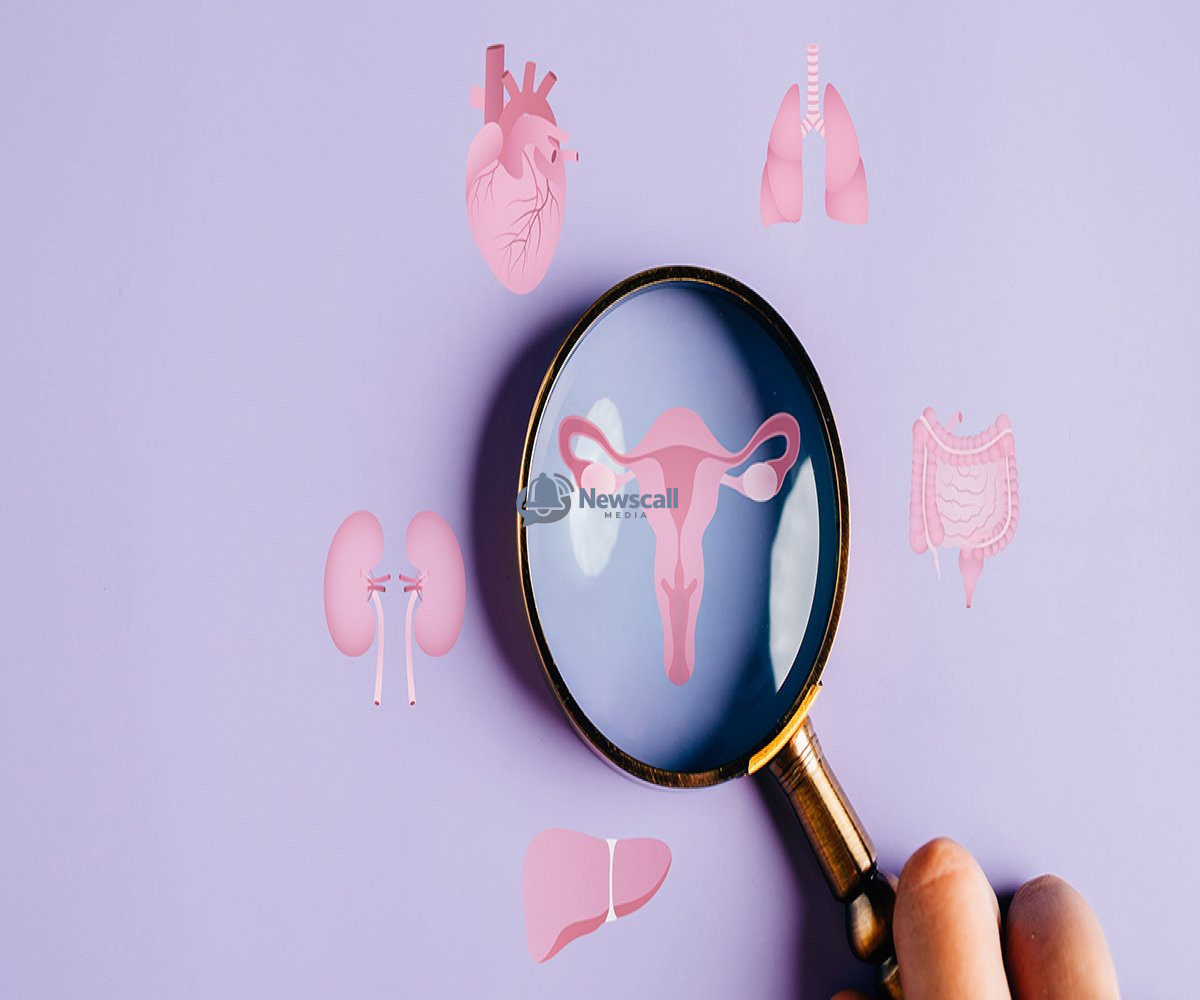 PCOS renamed PMOS to better reflect complex health effects
