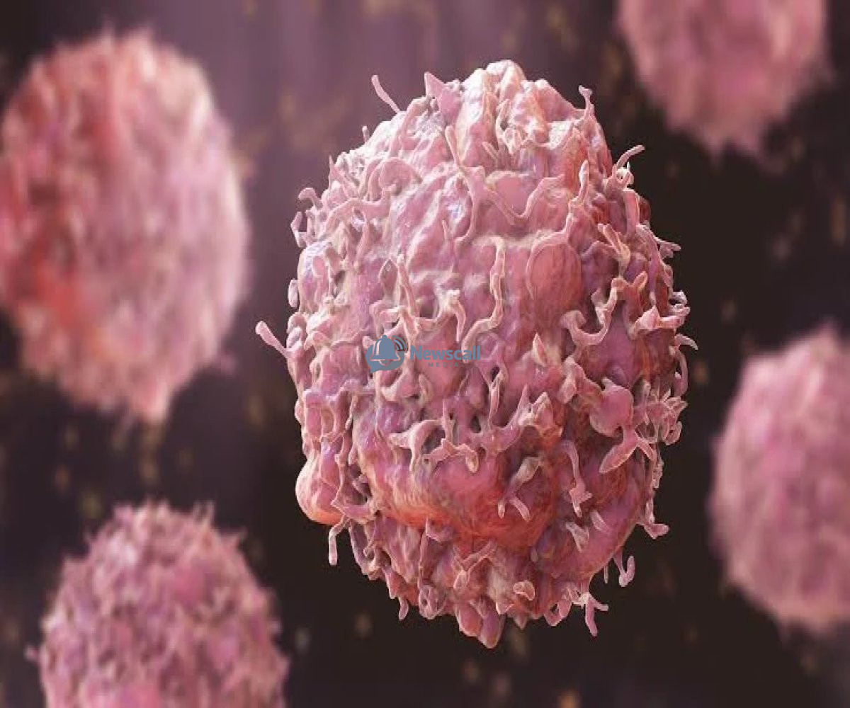 FG Unveils Major Plan to Make Cancer Treatment More Affordable for Nigerians.